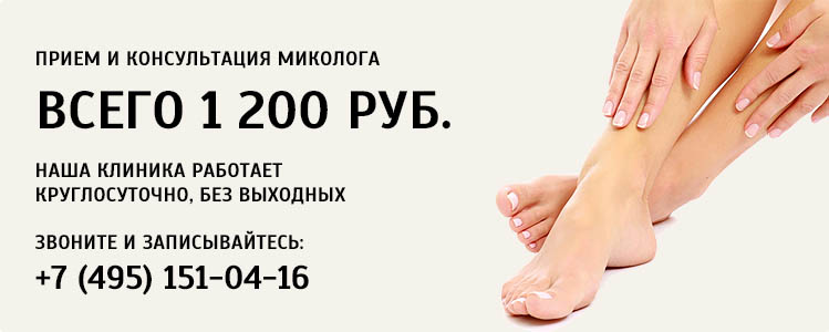 Бородавки вывести уксусом и чесноком